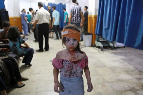 Wounded Syrian Girl